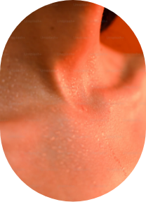 Improves sleep quality